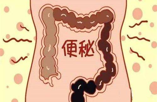 方法|便秘怎么快速排便，用对这几个方法，让大便像子弹般快速排出