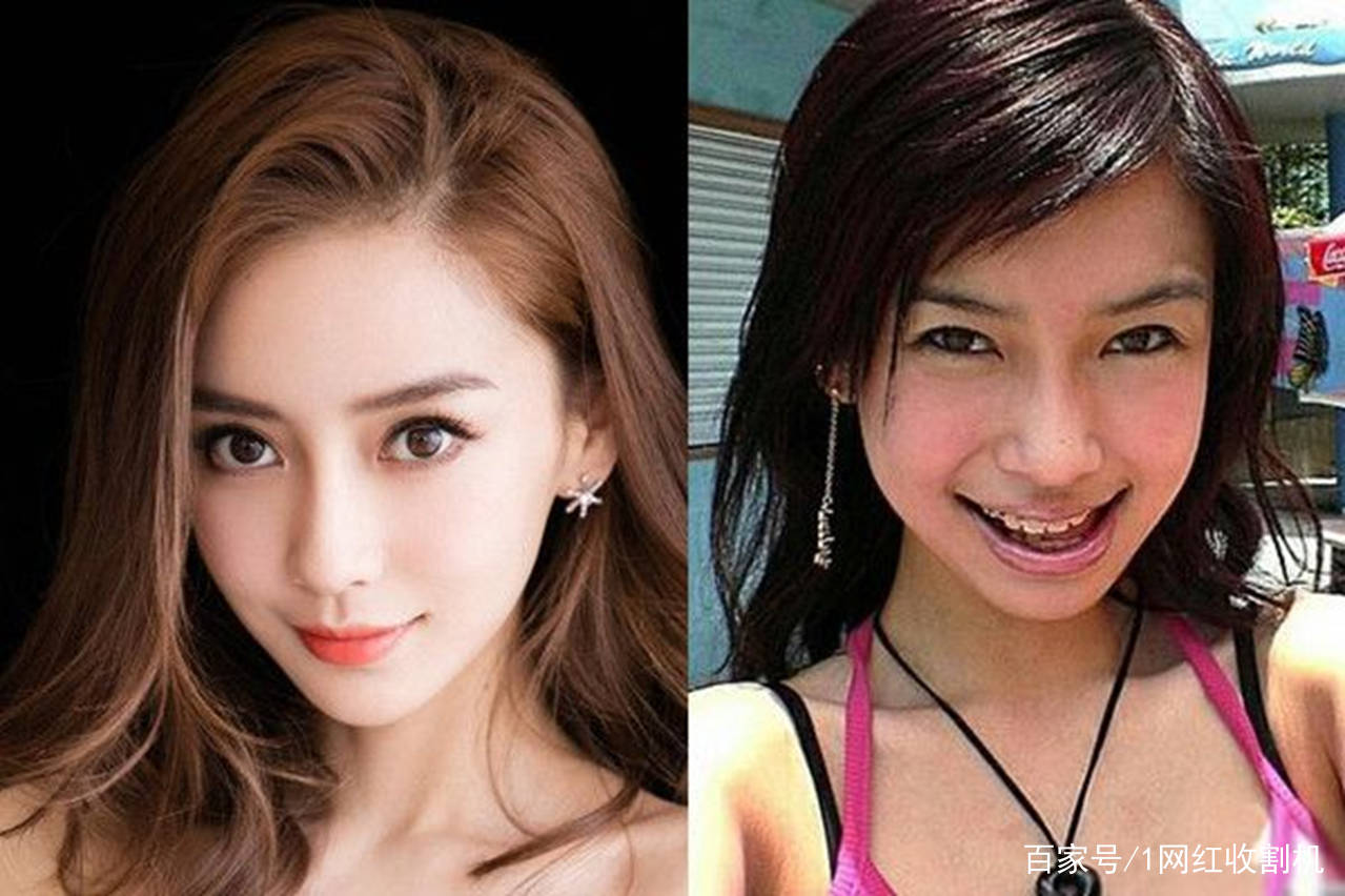 隆穹|太尴尬了!盘点8位明星“改头换面”后车祸现场,都是灾难(下)