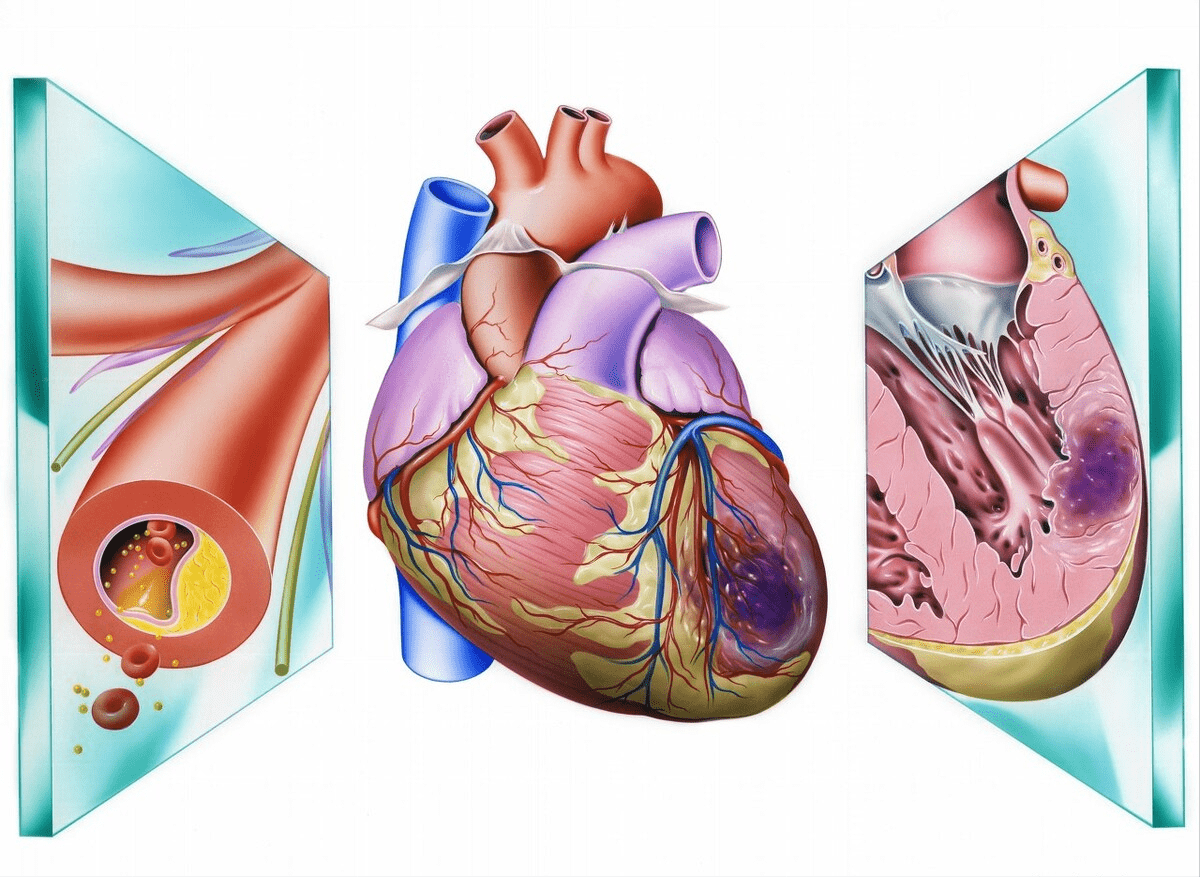 冠心病,心肌梗死患者,又没有高血压,为何要长期服用普利类药?