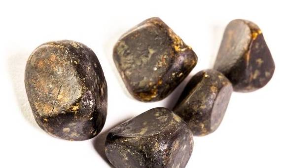 肾脏|肾结石太常见了?不想它“现身”,这3个很关键