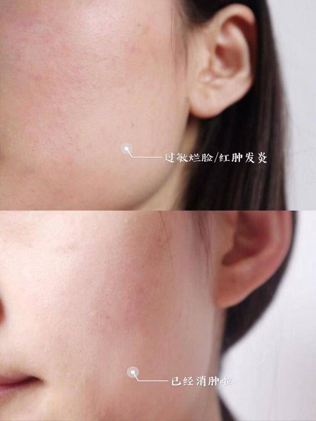 进行|这才是正确护肤步骤，你却先涂爽肤水，怪不得皮肤暗沉无光泽