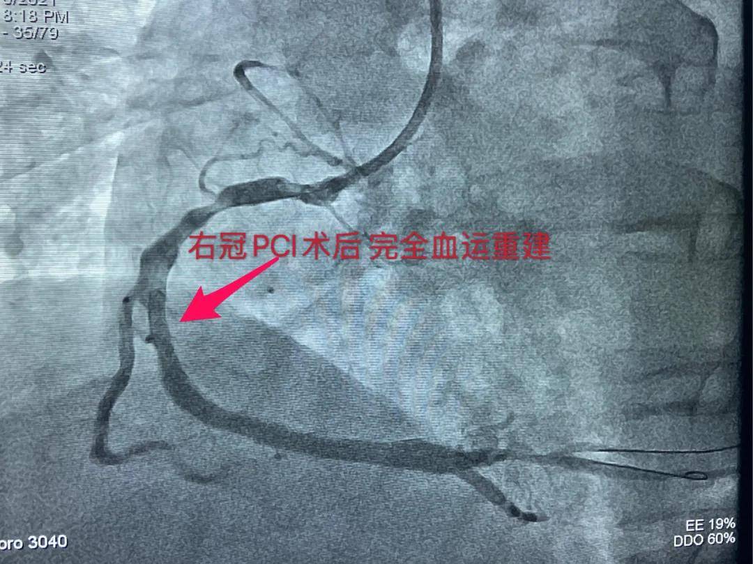 李逢春|丨急诊日记丨与死神竞速 同时间赛跑