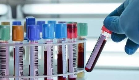 血管|早晨有了3种表现,最好去测一下血糖!可能是血糖升高了