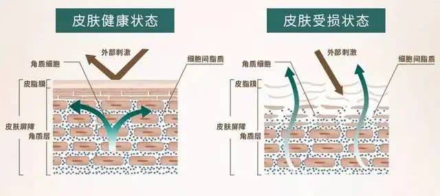 能力|重庆新依美美肤：皮肤屏障是什么？受损如何修复？