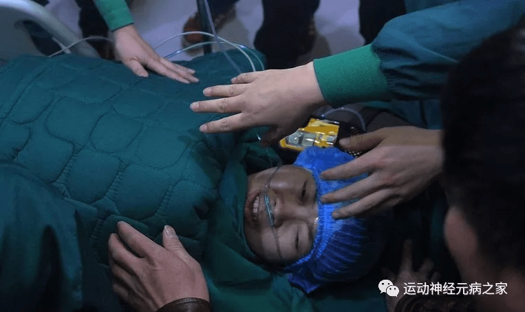 治疗|运动神经元病早期居然被误诊了？庸医？