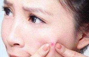 长期熬夜怎么调理脸部 8328e635349945b9a4686b9c1a1a56a6.jpeg