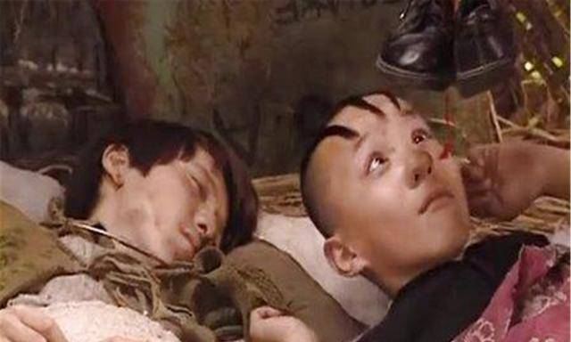 头皮|童星“三毛”因剃光头损坏毛囊，头顶缝300多针，现帅到认不出