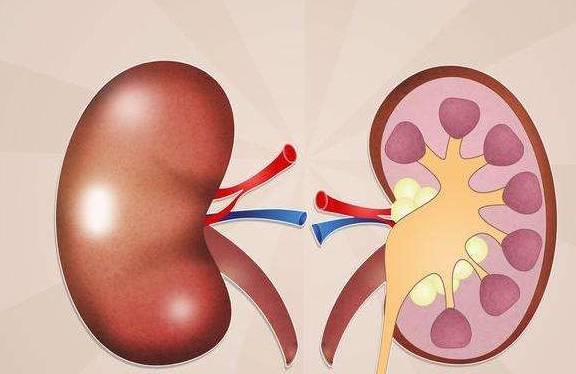 垃圾|晨起时,常做这三件事的男人肾脏会更好,可惜很多人不知道