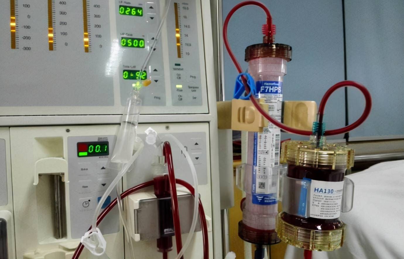 一次性使用血液灌流器主要用于尿毒症,中毒,重型肝病,自身免疫性疾病