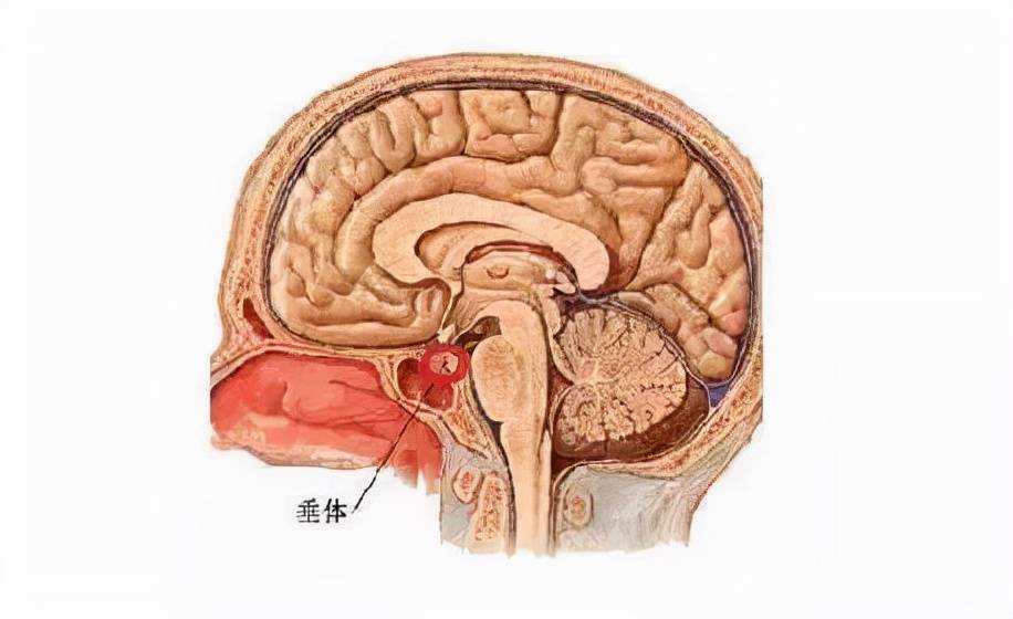 警惕!视力下降,竟是垂体瘤作怪