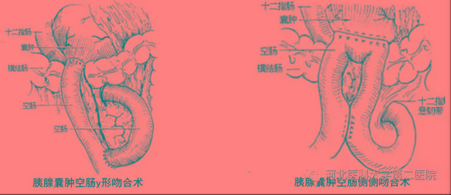 吕梁|新技术！山西省汾阳医院消化内科又一项联合技术填补吕梁空白