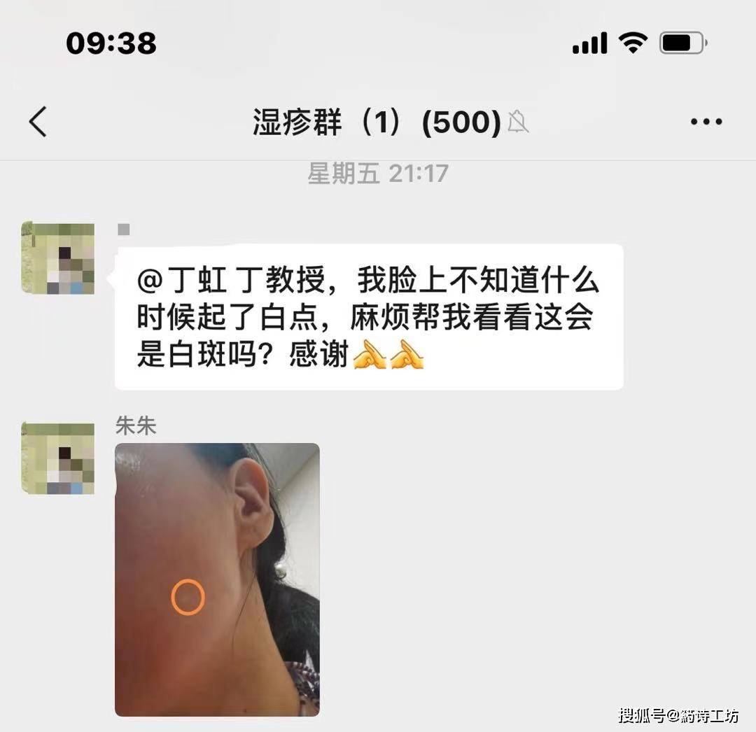 白点箹诗工坊:脸上不知道为什么会起白点，是白斑吗，应该怎么护理？