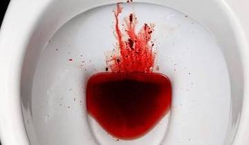 治疗|导致血尿的病因有哪些,血尿如何治疗好,多了解