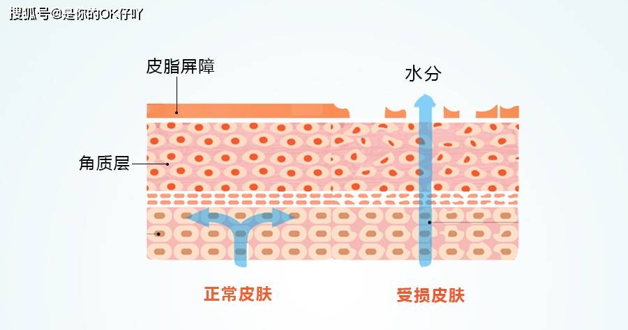 什么皮肤屏障受损怎么办？皮肤屏障有哪些表现？要怎么护理？