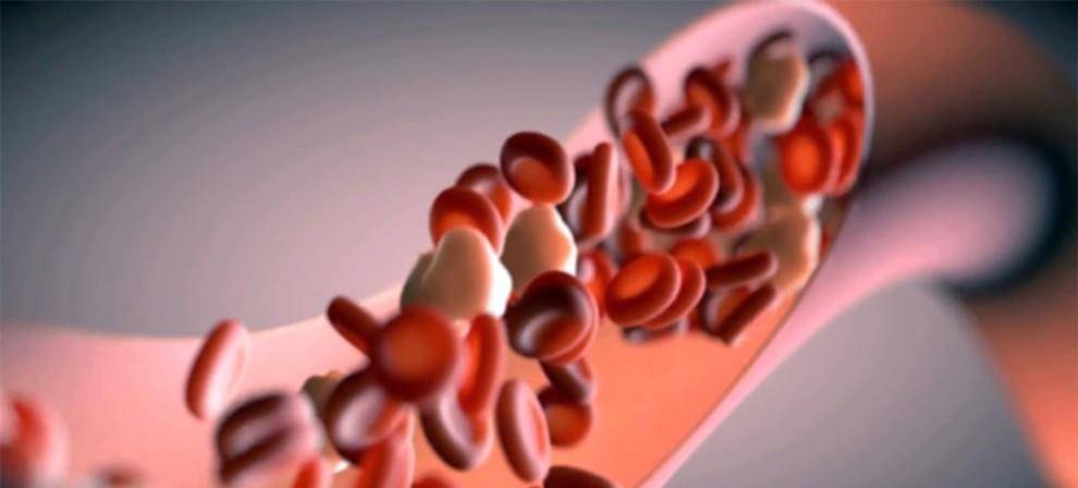 变化|患上脑血管瘤后，尽管平常只是洗了个澡，结果却悲剧了