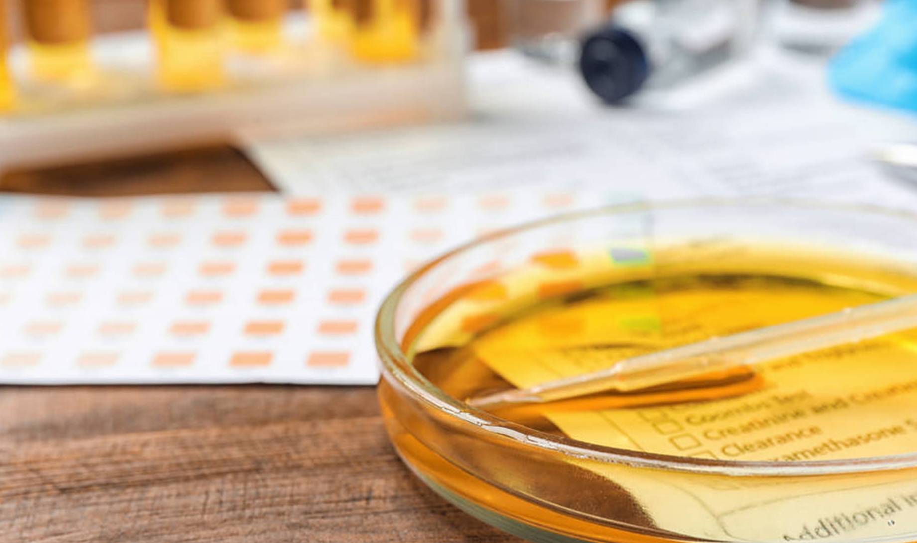 肾脏|身体若出现这4个症状,恐是尿毒症来“造访”,别一拖再拖