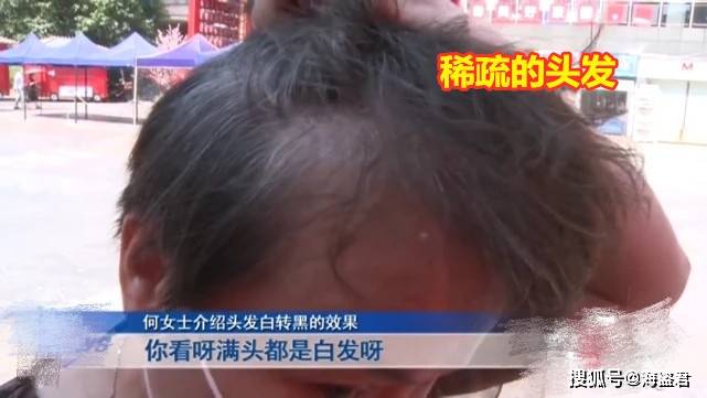 白转大妈美容院花4万“白发转黑”，头发变稀后哭诉：就是拔掉白头发