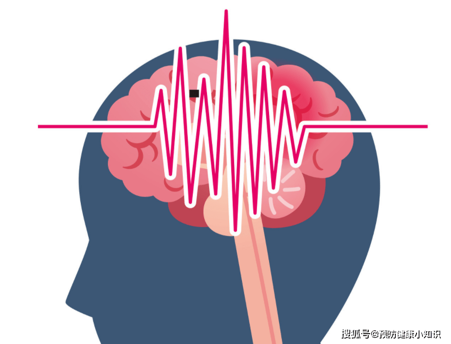 原創頭部的4個表現提示腦梗來了三件事勸你不要再做了