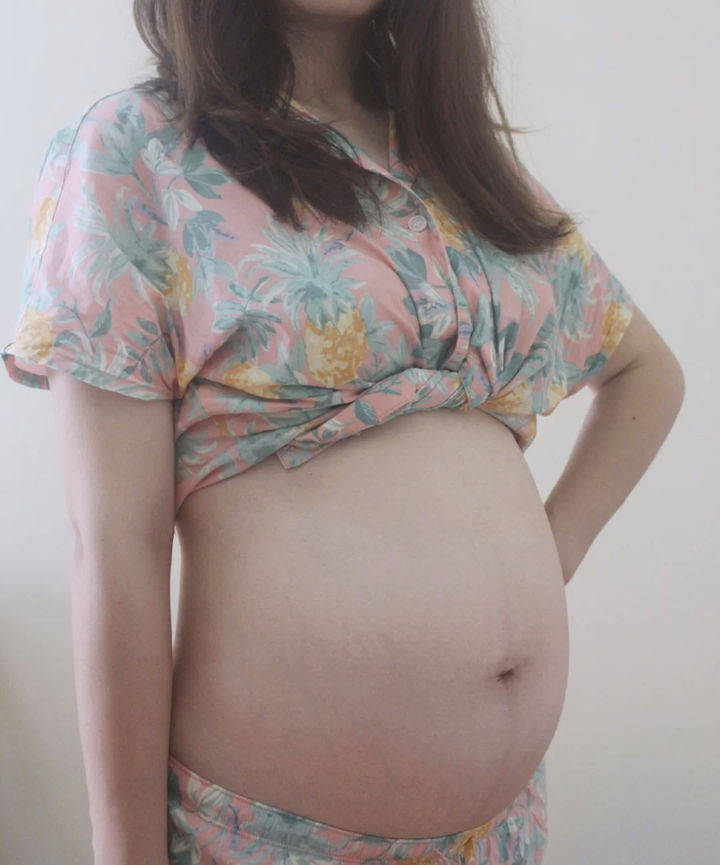 妊娠纹预防指南 怀孕到产后 孕妈不可错过的几种方法 快收藏 皮肤