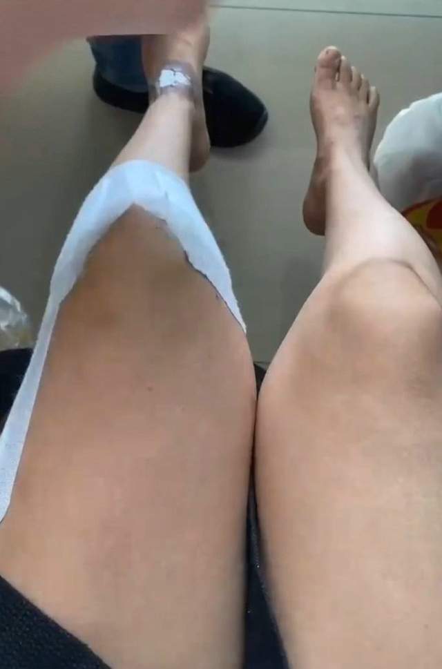 女子上瑜伽课被教练压断大腿 5.6万治疗费已超赔偿金_女士