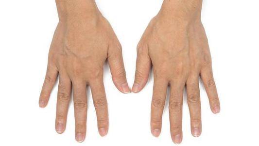 肝脏|肝好的人，看手“先知晓”？医生：手上有4个“迹象”，说明肝不错