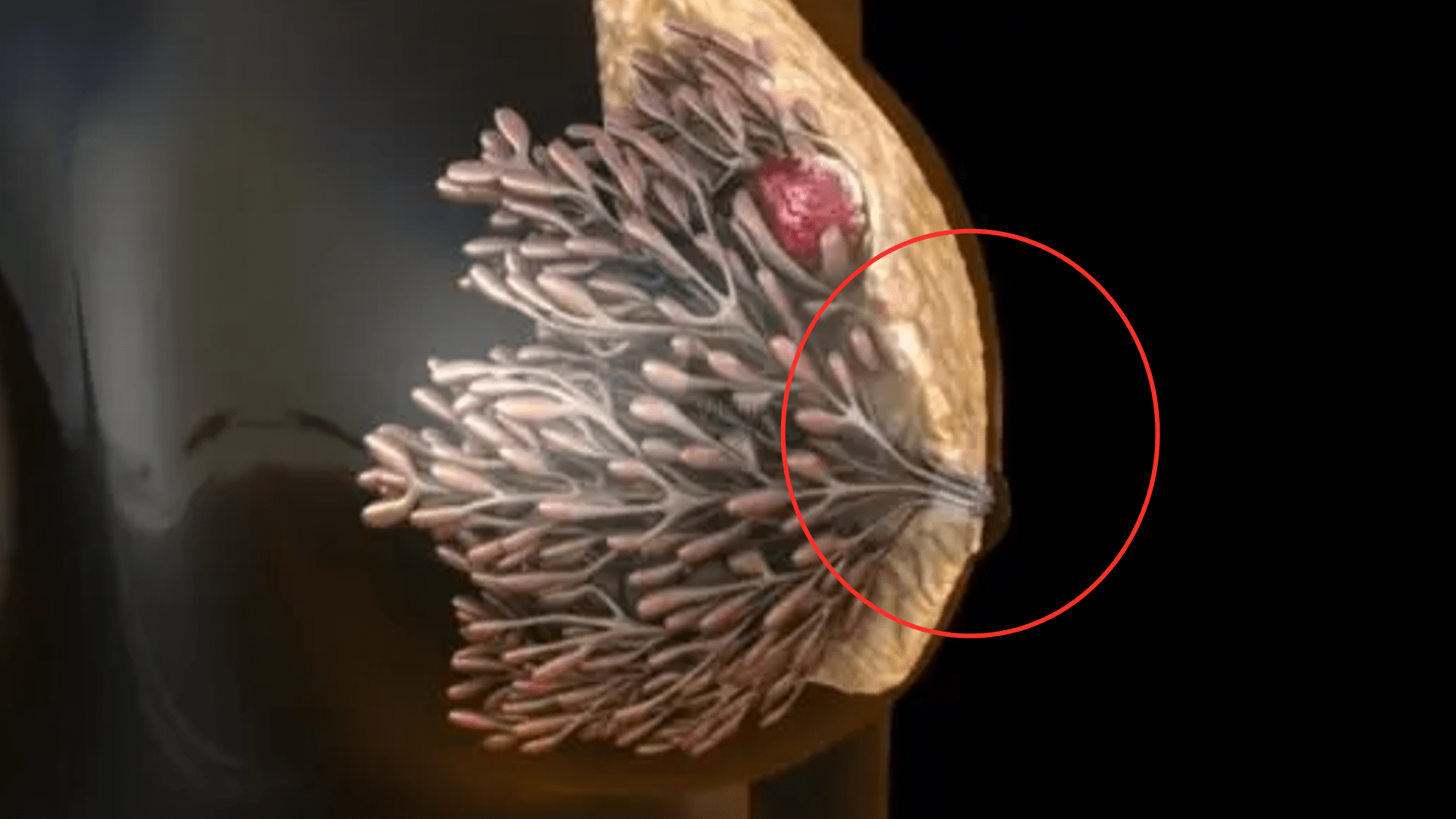 疫苗|仁义道德何在？癌症患者被迫出院后离世，美国紧张医疗资源