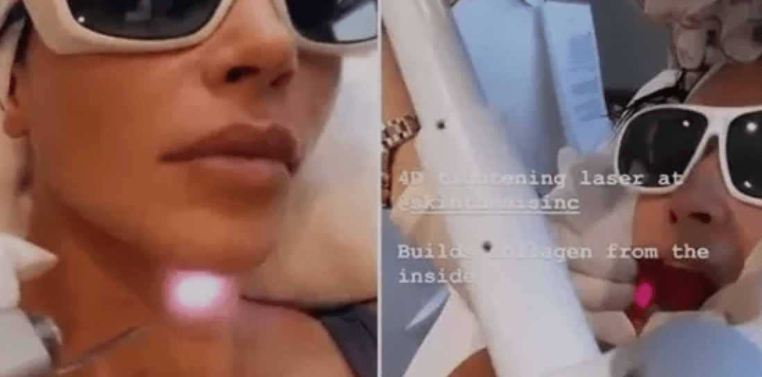 玛吉卡戴珊同款欧洲之星效果怎么样,为什么说欧洲之星效果不太行