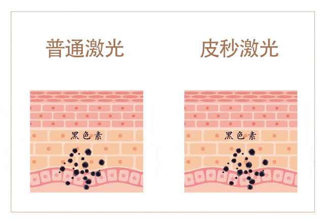 养护西安美莱丨如何科学的祛斑？维持保养？