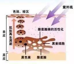 养护西安美莱丨如何科学的祛斑？维持保养？