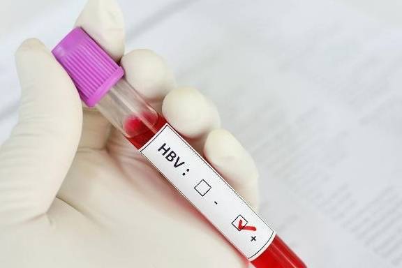 免疫|关于乙肝，你可能不了解这3件事，早认识早受益