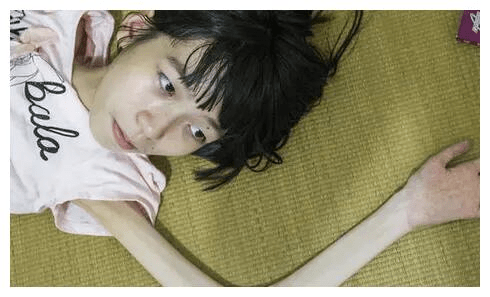 症状|运动神经元的危害有哪些？