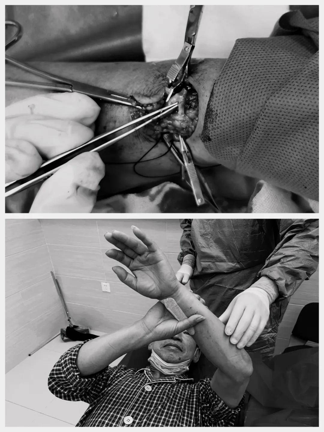 史井波|守瘘人｜“百密终无一疏”