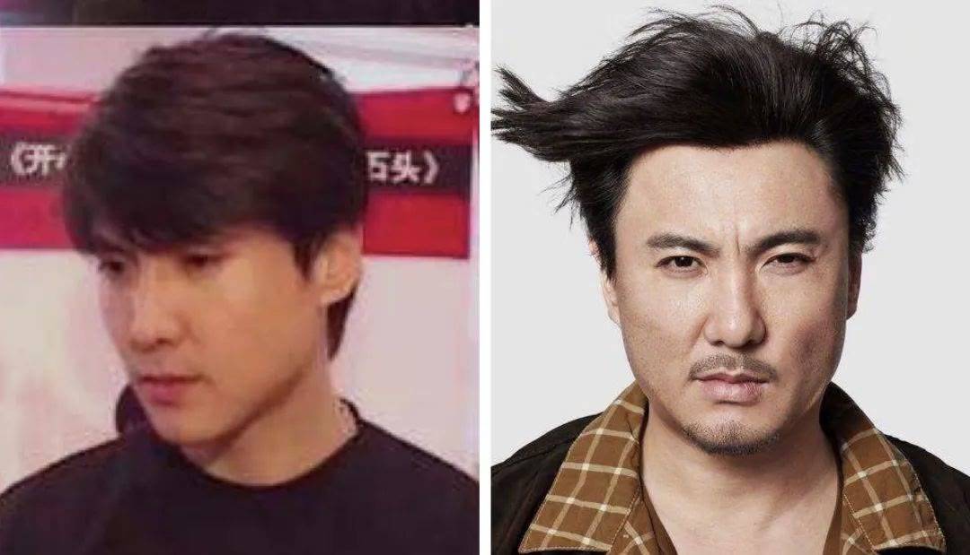 因为脸肿成猪头，神仙姐姐怎么变样儿了？