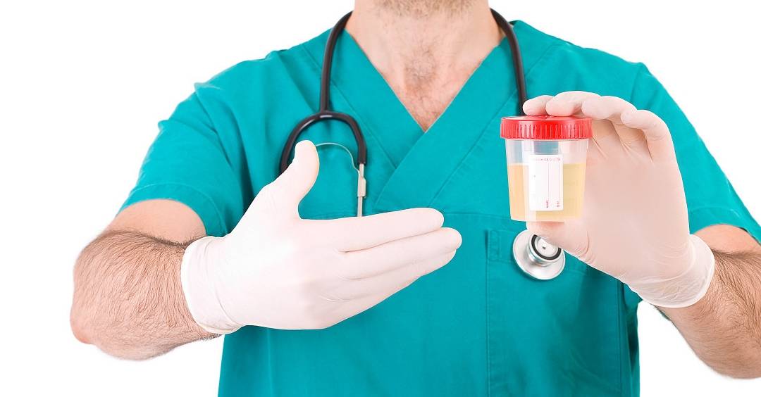 相关|尿检查出潜血而且有3个加号,是什么原因?今天,来告诉各位答案