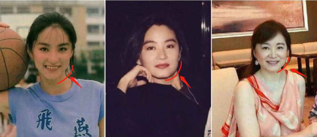 因为脸肿成猪头，神仙姐姐怎么变样儿了？