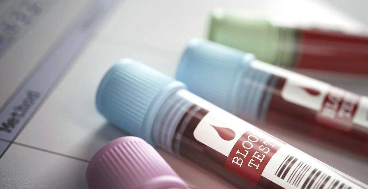 他汀|长期服用他汀类药物的时候,最应该注意的几个问题,不能忽视