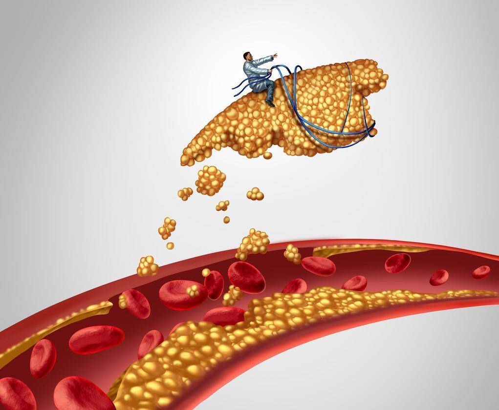 他汀|阿托伐他汀的服用周期是多久，可以长期吃么，能不能停药呢