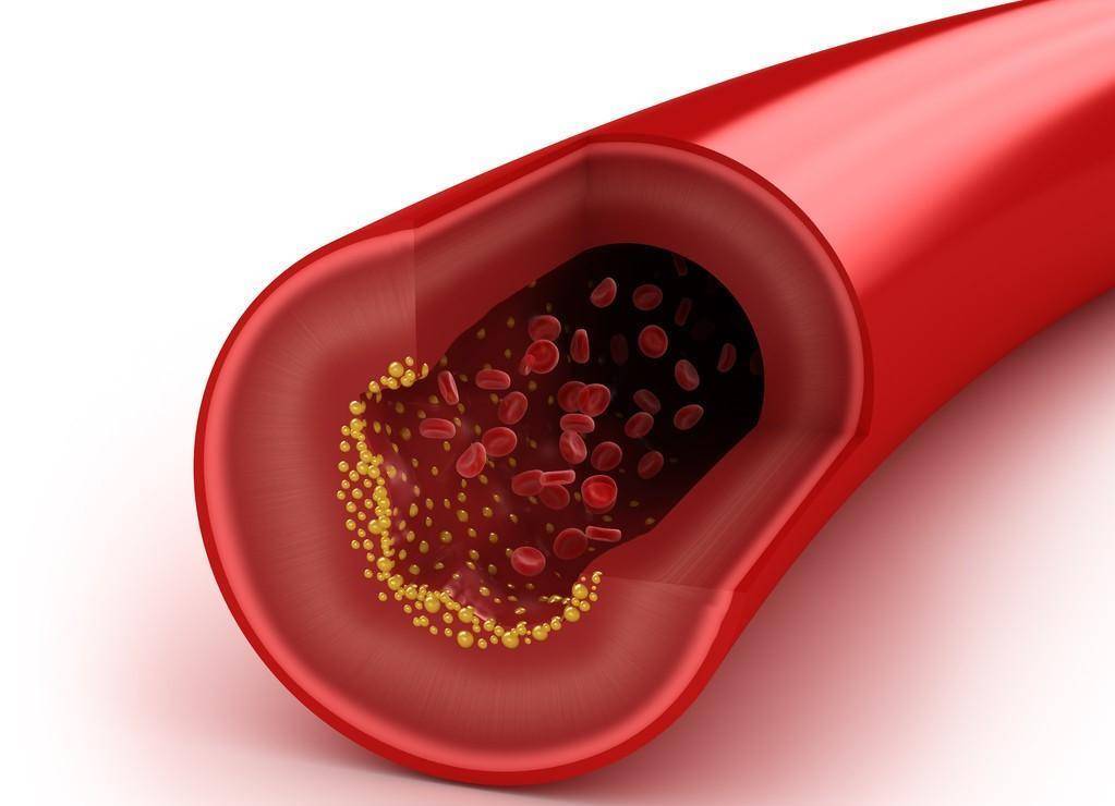 范围|经过降脂治疗,血脂达到正常了,降脂药还需要继续服么?