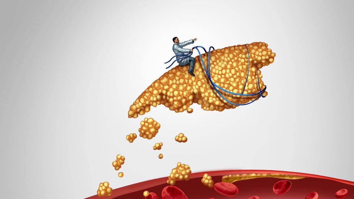 水平|血脂检查中，“脂蛋白a”与“载脂蛋白A”，哪个升高了有危险？
