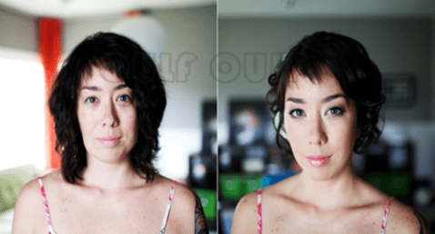 后很救命~自体脂肪填充后很后悔，脂肪填充失败修复怎么做？解决方法！