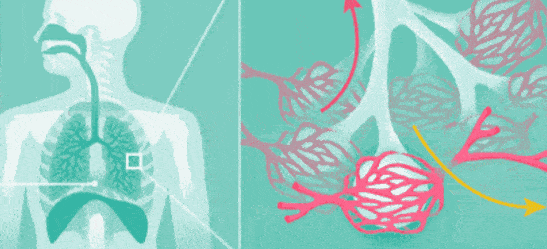 防护|慢阻肺是一场漫长而痛苦的葬礼：进入流感高发季，慢阻肺患者需格外当心！