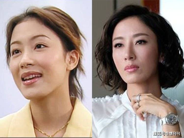 结局整容风刮到香港，这7位港圈大美人竟跑去DO脸上，结局一言难尽