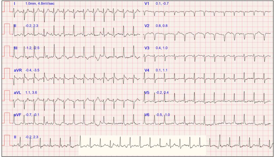 检查|装病？32岁女子一干活就晕倒！婆家人也不理解