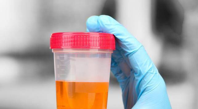 肿瘤|尿液是身体的一面镜子，老年男性注意尿液变化，不能忽略3种问题