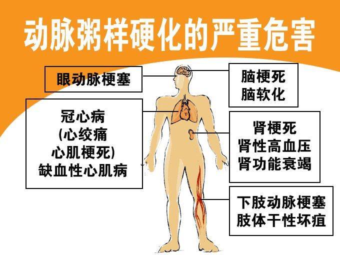 如何让心脏加快跳动 a6e31d5ed66d4e95be2906f1b97c8964.jpeg