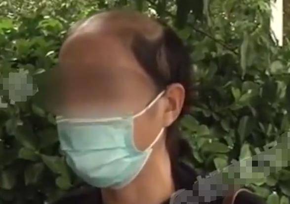 崩溃河南一女子美容医院整形后竟变秃头，崩溃痛哭不想活：你还我头发