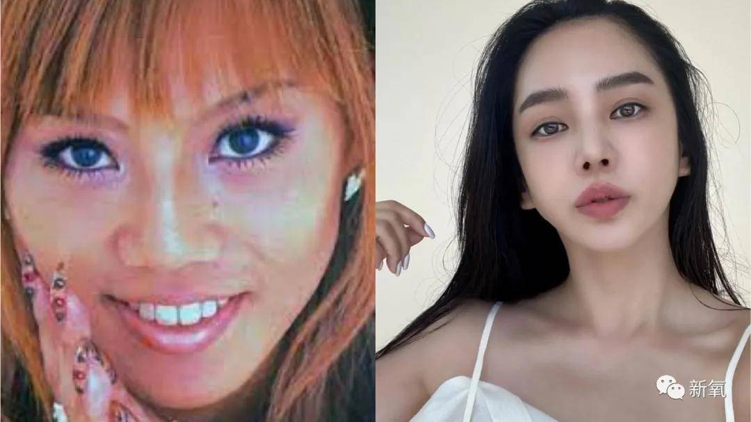 整形整形天选之人vs整完只会吓人，区别在哪里？