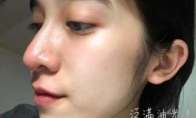 症状假如脸上这3个症状明显，那你面部可能有“螨虫”，需要尽早改善