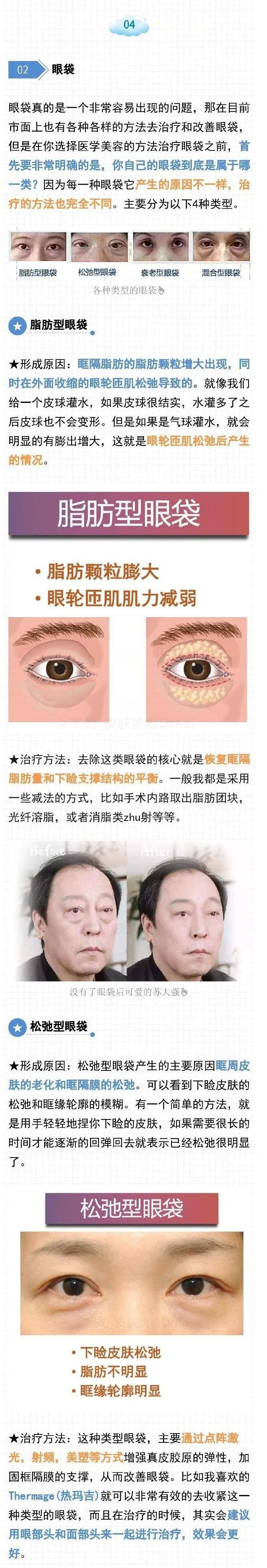 分析最系统的眼部抗衰，不要在单纯的为眼霜交智商税？