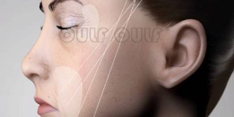 分析专业分析:蛋白线埋线一根多少钱?胶原蛋白线这个价格贵不!靠谱吗